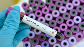 Coronavirus Test Labor Foto iStock Jarun011.jpg